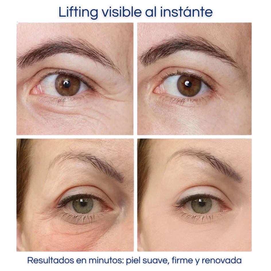 LumiOjos - Crema Instantánea Lifting de Ojos – Levanta y Refresca los Ojos Cansados